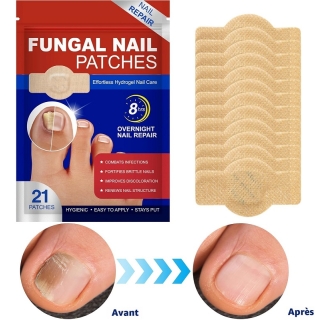 Patchs antifongiques pour les ongles (21 pièces)